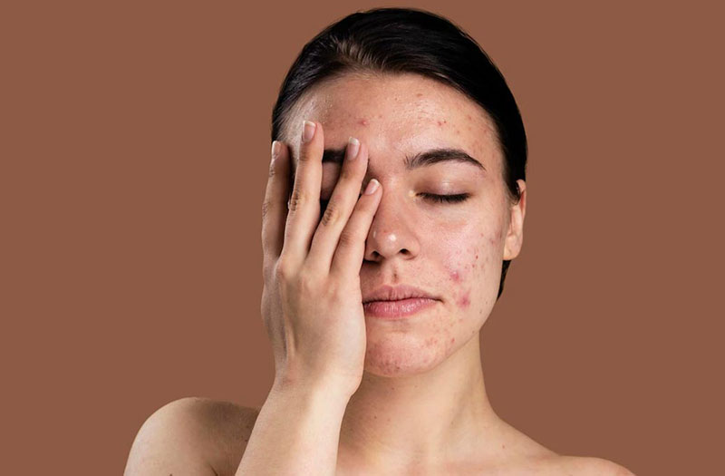 Da nhạy cảm – Nguyên nhân, cách chăm sóc và giải pháp từ Numis Med