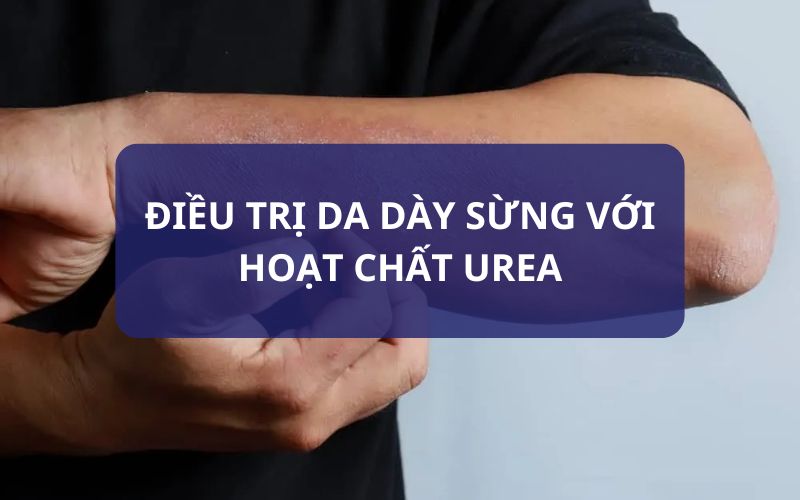 ĐIỀU TRỊ DA DÀY SỪNG VỚI HOẠT CHẤT UREA