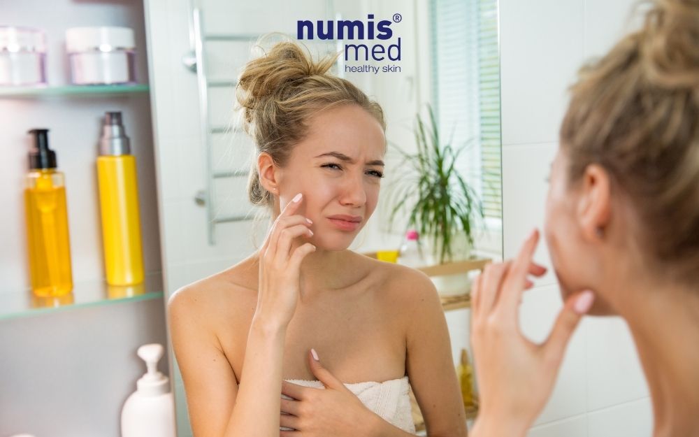 Dấu hiệu da nhạy cảm & Phân biệt kích ứng, dị ứng mỹ phẩm