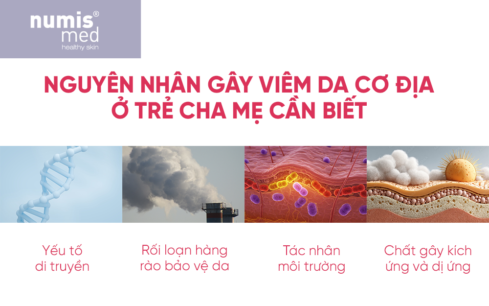7-dau-hieu-nhan-biet-som-viem-da-co-dia-o-tre-nho